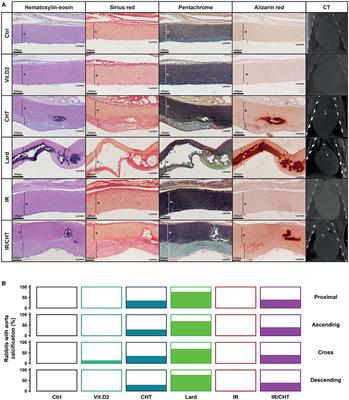 Differential Biological Effects of Dietary Lipids and Irradiation on the Aorta, Aortic Valve, and the Mitral Valve